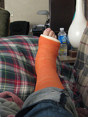 leg cast